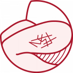 Lesioni vascolari Lesioni vascolari